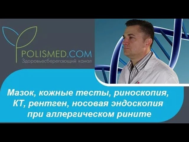 Мазок, кожные тесты, риноскопия, КТ, рентген, носовая эндоскопия при аллергическом рините