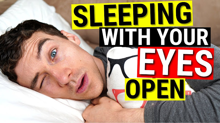Sleeping with Eyes Open - Dry Eye Treatments for Lagophthalmos