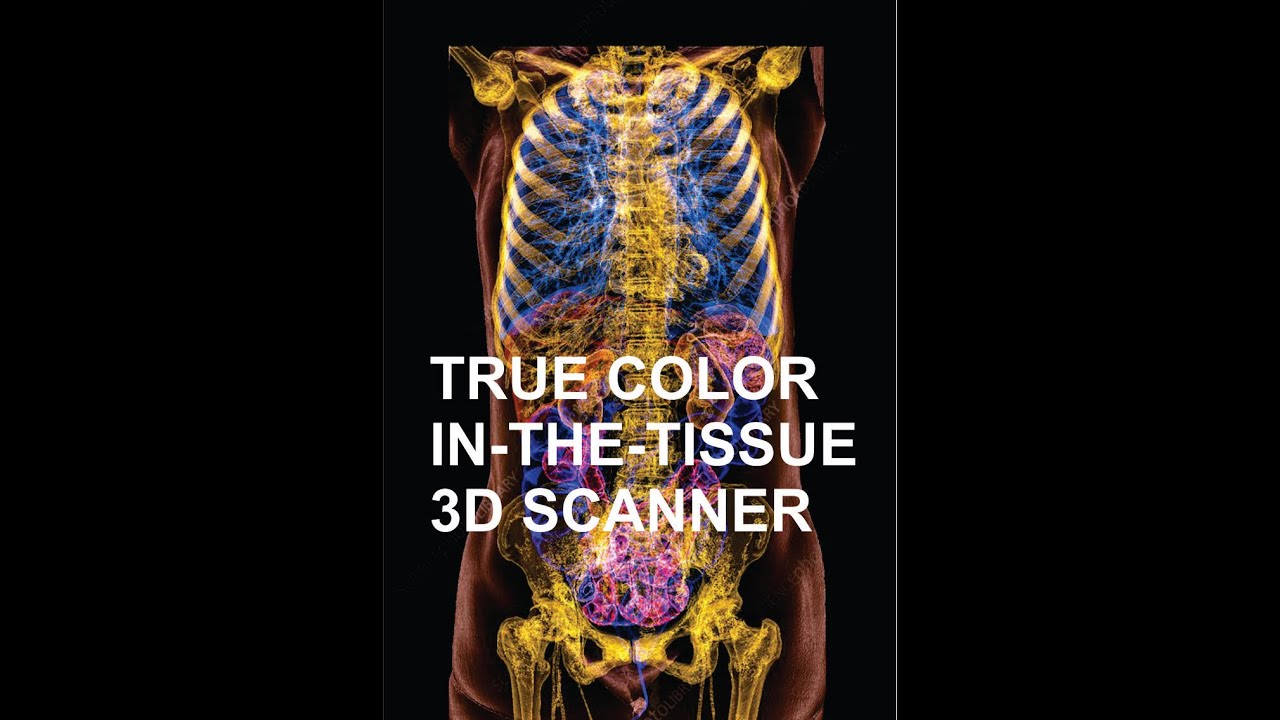 TRUE COLOR IN-THE-TISSUE 3D SCANNER - YouTube