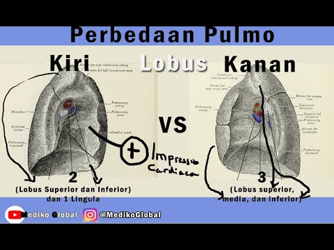Anatomi Pulmo: Paru Kiri vs Paru Kanan