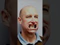 Creating the Perfect Smile  My Journey with Smile Creator in EXOCAD #Shorts #shortvideo #short