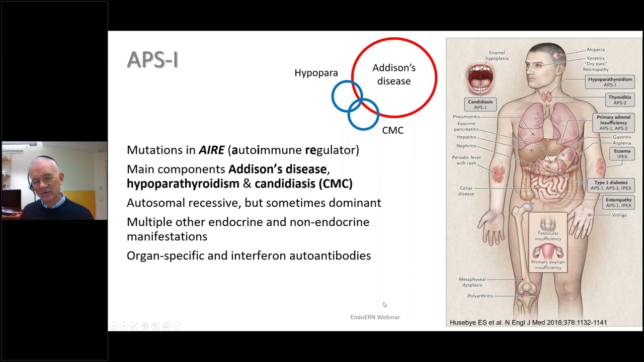 Primary adrenal insufficiency   diagnosis, treatment and follow up illustrated by cases