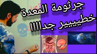 ما هى جرثومة المعدة الخطيرة ؟ علاج جرثومة المعدة وأهم أعراضها و الوقاية منها H. Pylori