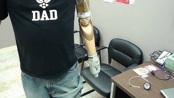 Otto Bock dynamic arm.  Allen working with new prototype prosthesis.  Transhumeral