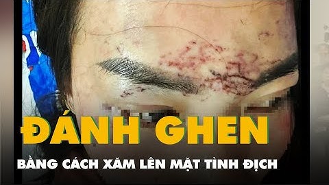 Công an xác minh vụ đánh ghen bằng cách xăm lên mặt ‘tình địch’ xôn xao dư luận ở Cà Mau