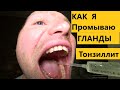 Как я промываю гланды (миндалины)