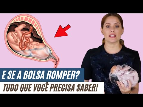 Vídeo: Você pode estar em trabalho de parto sem romper a bolsa?