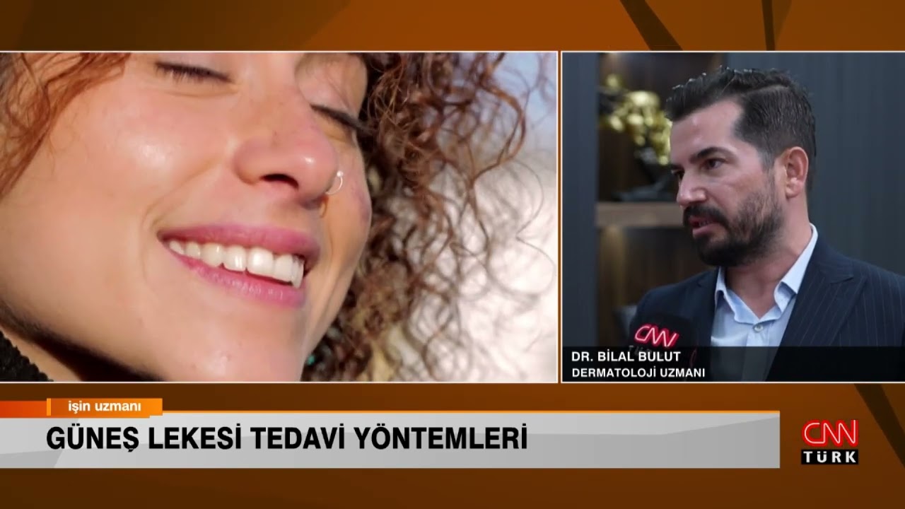 İŞİN UZMANI/ GÜNEŞ LEKESİ TEDAVİ YÖNTEMLERİ/ DR. BİLAL BULUT (3 AĞUSTOS 2023)