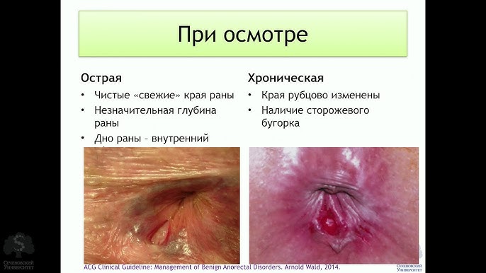 Қарау ананың порно видео