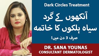 How To Get Rid Of Dark Circles In Urdu | Ankhon K Halky Door Karne Ka Tarika |Dark Circles Treatment