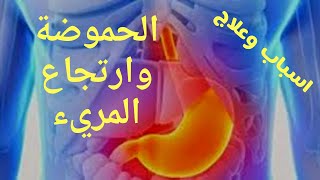 كيف تتخلص نهائيا من حموضة وحرقان المعده / ارتجاع المريء / اخطر العادات والاكلات