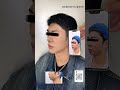 3D定制PEEK下巴 #mtf #mff #ts #ffs #Transgender #duet #pregnant #massage #skincare #hospital #nurse