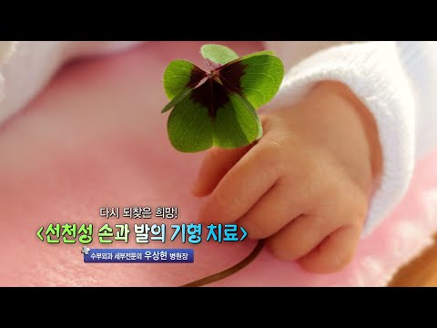 선천성 손과 발의 기형 치료 - 수부외과 세부전문의 우상현 병원장
