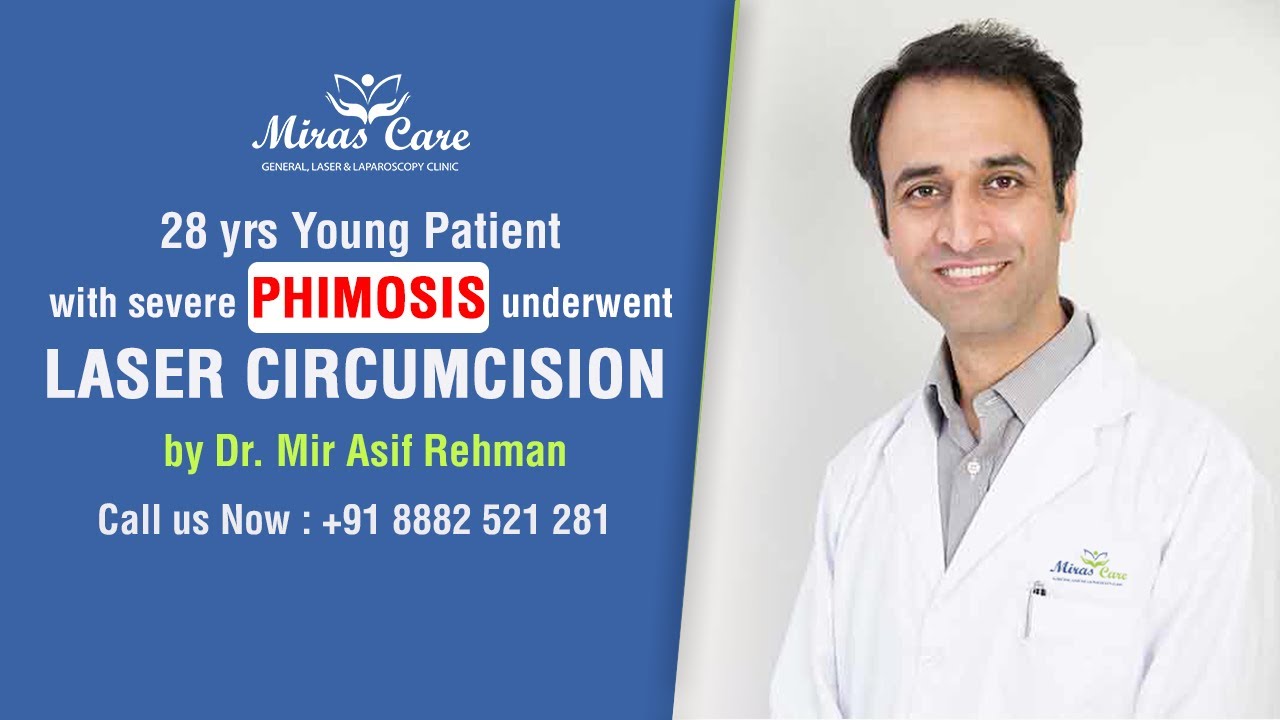 Painless Laser Circumcision Surgery for Severe Phimosis in Young Male
