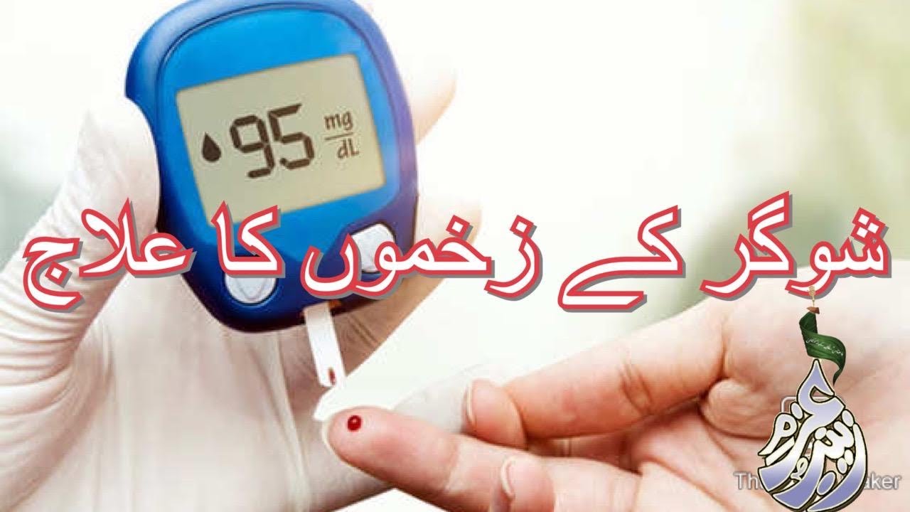 Sugar Ke Zakhmon Ka Illaj Diabetes Treatment Syeda Amber Naqvi