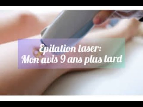 Mon epilation laser- Avis 9 ans plus tard - YouTube