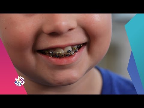 تقويم الأسنان للأطفال .. الأسباب والتقنيات | صباح النور
