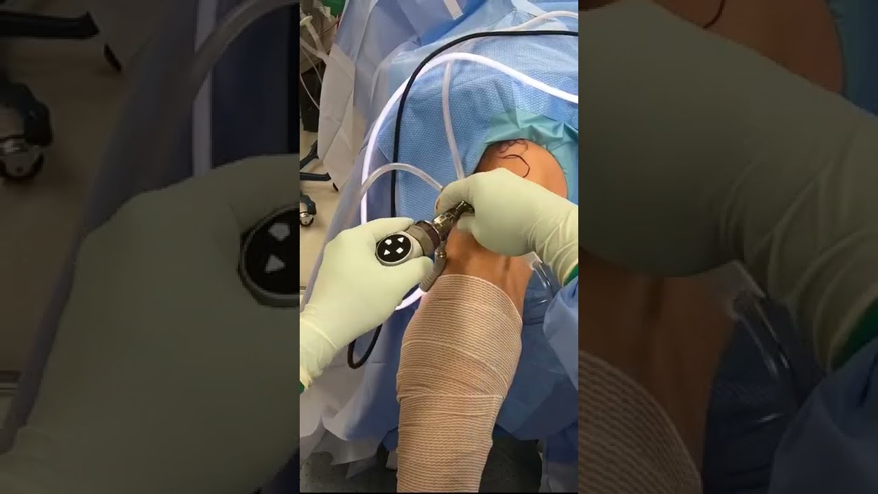 Inside The Operating Room For Meniscus Repair Shorts