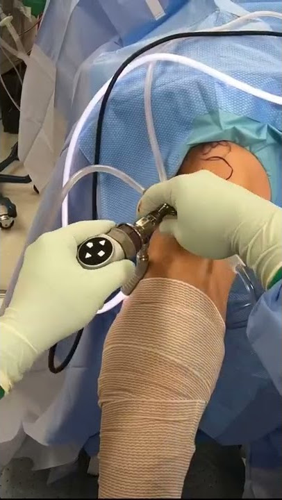 Inside the Operating Room for Meniscus Repair #shorts