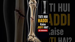 Bone Healing Process Explained in 3D Animation | #shorts #education