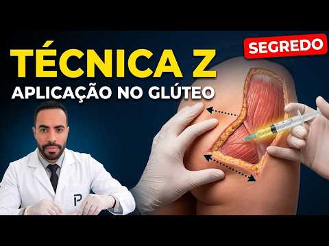 A técnica em Z que ninguém te ensinou na escola (aplicação intramuscular)