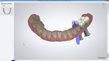 3DBioCAD - 3Shape Dental System Model Builder Implant Model