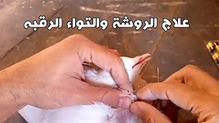 علاج الروشة والتواء الرقبة عند الحمام وفك العقده بطريقه سهلة وبسيطة