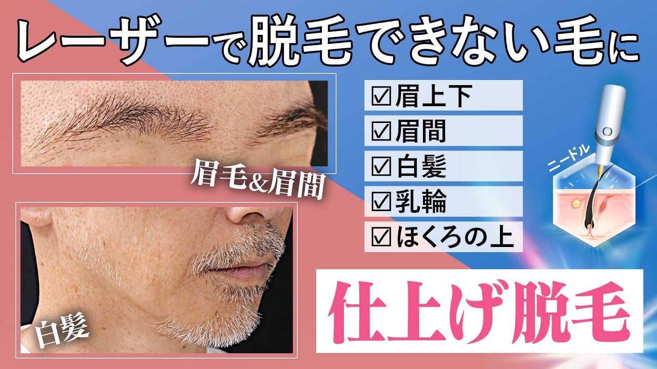脱毛・除毛 NATIONAL ER5209 Amazon.co.jp: 脱毛器 こするだけ 脱毛 『業界新傑作！痛みゼロ