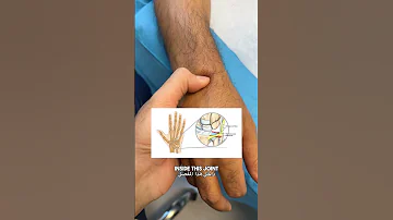 الأربطة والأوتار في مفصل اليد وكيفية علاج الإصابة فيها 