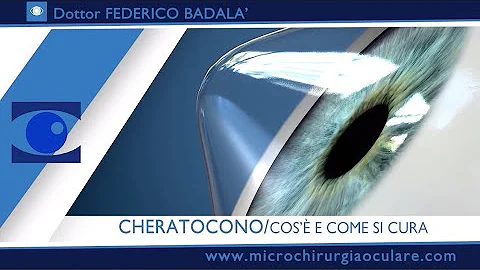 Come si guarisce dal cheratocono?