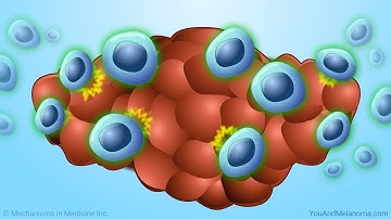 Tumor Infiltrating Lymphocyte (TIL) Cell Therapy in Melanoma