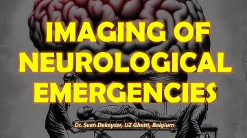 Imaging of Neurological Emergencies.