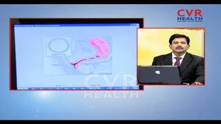 amazing solutions to Kidney & Infertility Problems|Reasons & Treatment |Dr Kammela Sreedhar |14-8-19