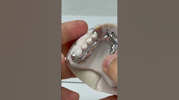 Super light titanium partial