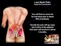 Low Back Pain Could Be Complicated - Everything You Need To Know - Dr. Nabil Ebraheim