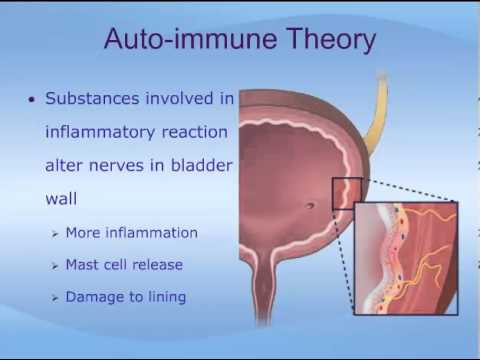 Understanding Interstitial Cystitis (IC)