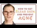 How To Get Clear Skin & Prevent Acne - Skincare Tips for Men