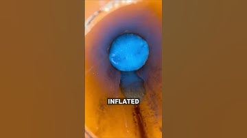 How they fix pipes without digging