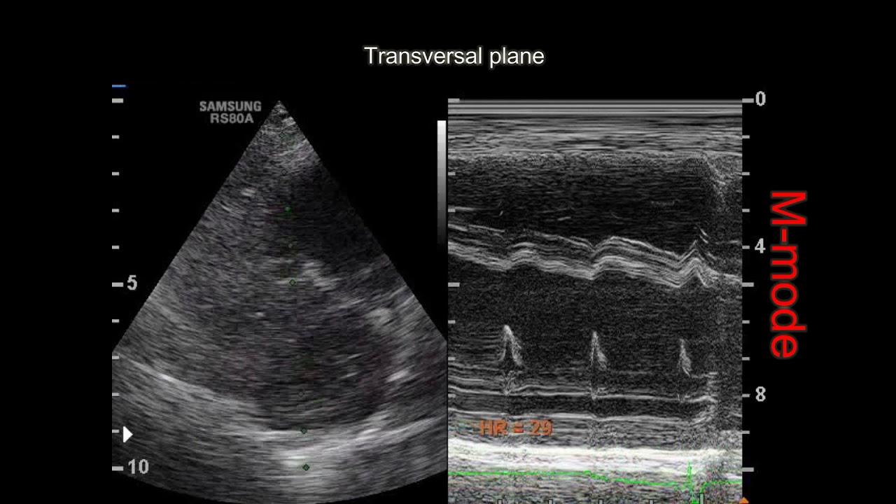 3rd degree heart block in a dog YouTube