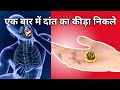 How To Gat Ride Of Tooth Cavity। दांत का कीड़ा कैसे निकले। आयुर्वेद।Dental cavity।dental pain remove