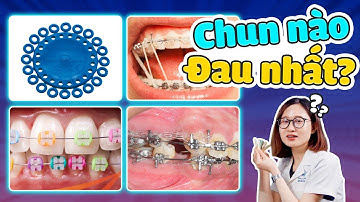 Các Loại Chun Niềng Răng - Đeo Chun Nào Đau Nhất Khi Niềng? Tiết Lộ Bất Ngờ Từ Bác Sĩ