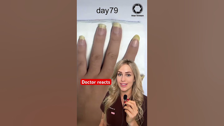 What happens when you don’t cut your fingernails