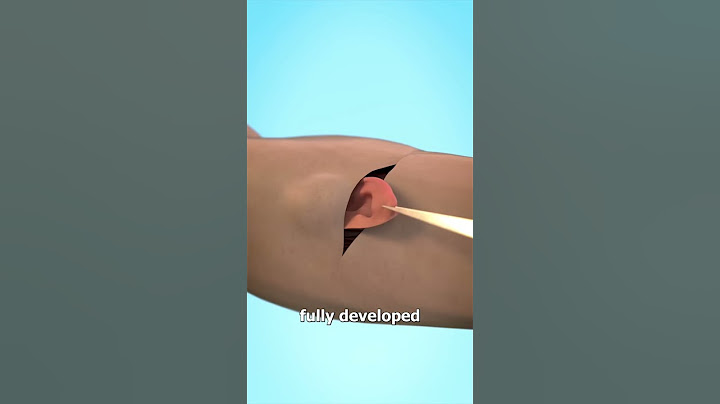 Growing An Ear In Your Arm😱