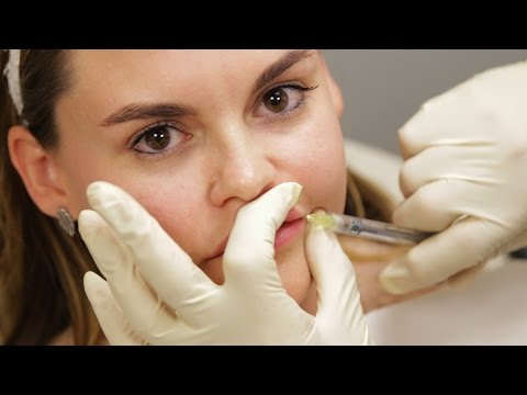 Women Get Lip Injections For The First Time
