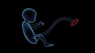 تفسير حلم رؤيا اجهاض الجنين ورؤية موت الجنين في المنام