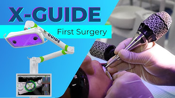 Our First X-Guide Implant Surgery