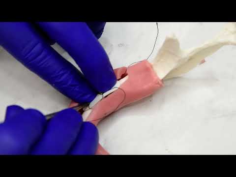 W Periosteal Suture