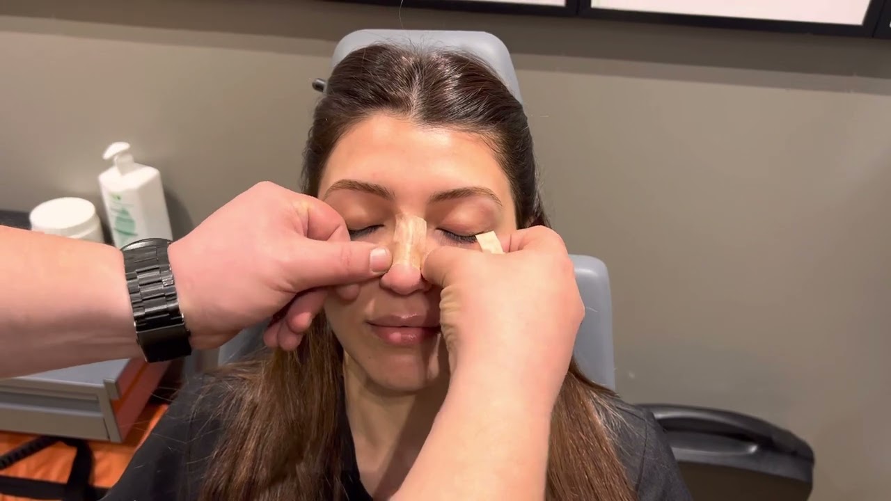 HOW TO TAPE NOSE AFTER RHINOPLASTY YouTube