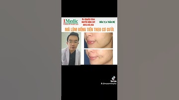 Cắt má lúm đồng tiền Cà Mau Bs chuyên khoa NGUYỄN ĐẶNG DUY 0919449459 IMedic Y Khoa Kỹ Thuật Cao