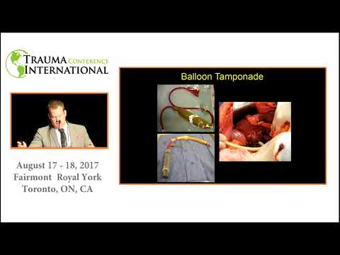 Massive Liver Trauma: A Stepwise approach (English) 2017